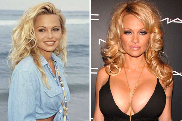 Most Expensive Celebrity Plastic Surgeries Was It Worth It Pop Hitz Celebrity Gossip