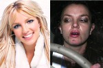 You Wont Believe These Photos Of Celebrities Before And After Drugs Pop Hitz Celebrity