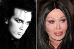 Most Expensive Celebrity Plastic Surgeries Was It Worth It POP Hitz Celebrity Gossip