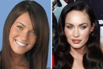 Most Expensive Celebrity Plastic Surgeries Was It Worth It POP Hitz Celebrity Gossip