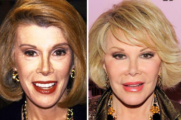 Most Expensive Celebrity Plastic Surgeries Was It Worth It POP Hitz Celebrity Gossip