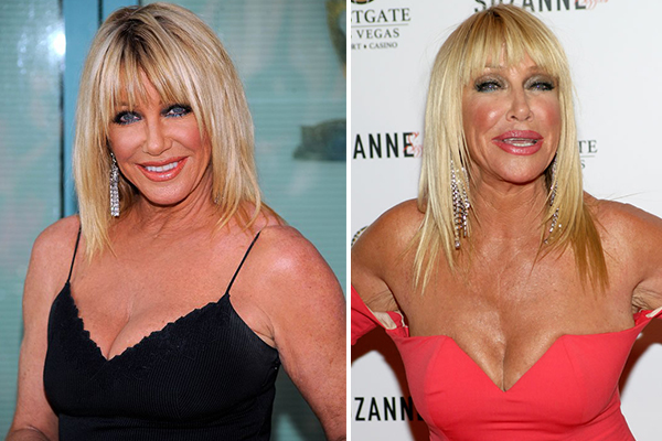 Most Expensive Celebrity Plastic Surgeries Was It Worth It POP Hitz Celebrity Gossip