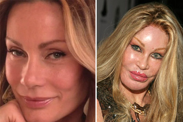 Most Expensive Celebrity Plastic Surgeries Was It Worth It POP Hitz Celebrity Gossip